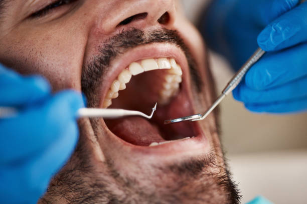 Best Urgent Tooth Repair  in Price, UT